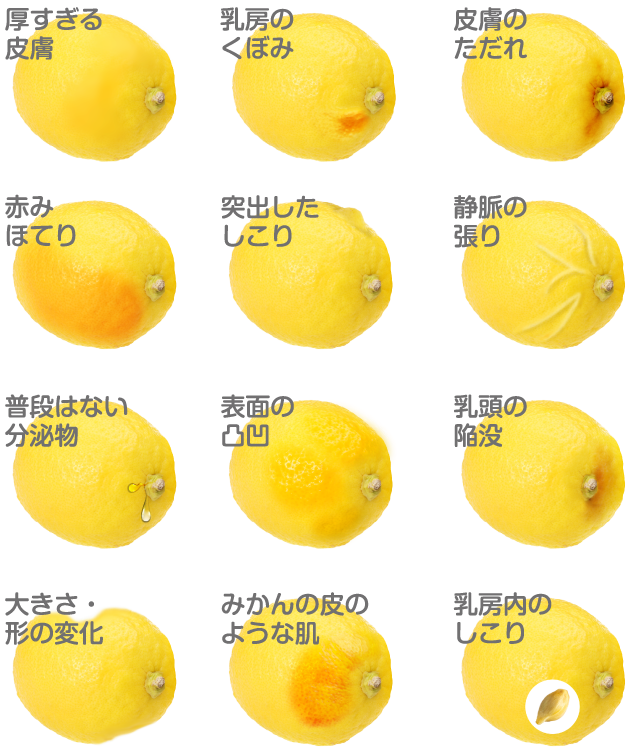 乳腺外科 乳がん検診 診療科目のご案内 熊本市 産婦人科 無痛分娩 小児科 慈恵病院 乳腺外科 乳がん検診 診療科目のご案内 熊本市 産婦人科 無痛分娩 小児科 慈恵病院
