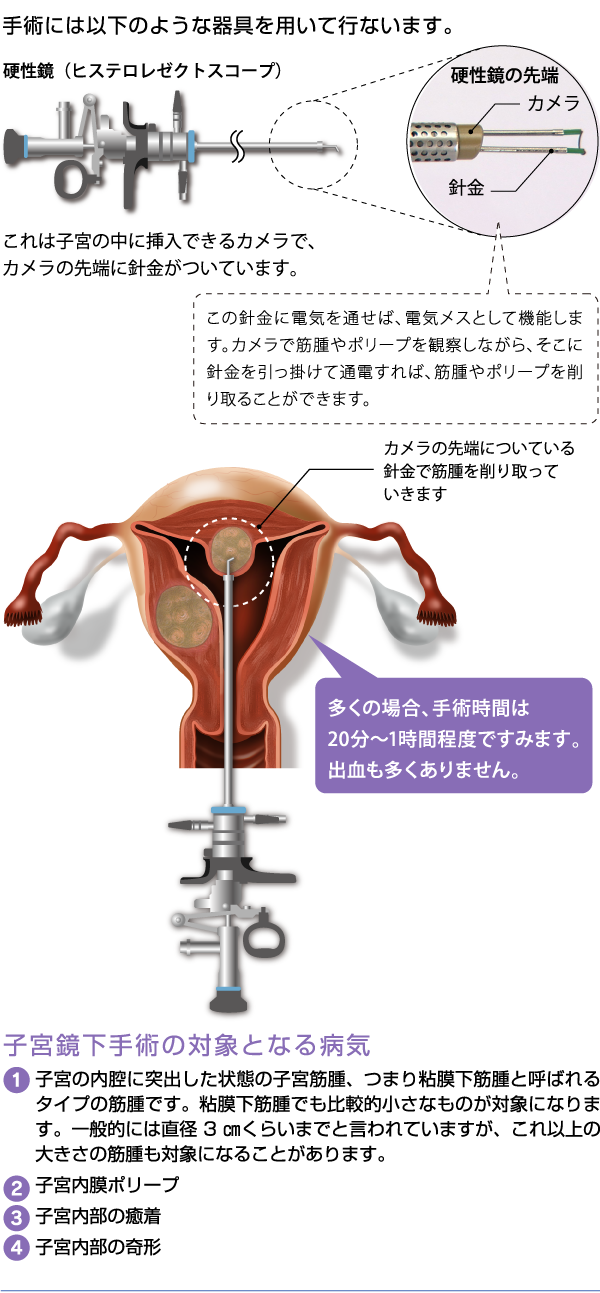 子宮鏡手術 熊本市 産婦人科 無痛分娩 小児科 慈恵病院